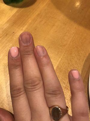 Ring and middle finger peeled off 2 days after mani