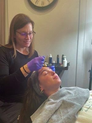 Tara performing a surface level chemical peel!