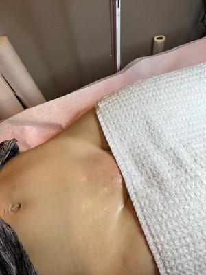 Brazilian wax