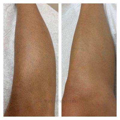 Lower leg wax