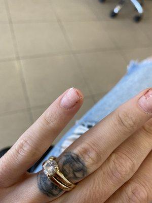 NAIL TIP RIPPED FROM NAIL BED