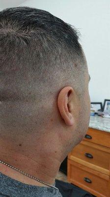 Skin fade