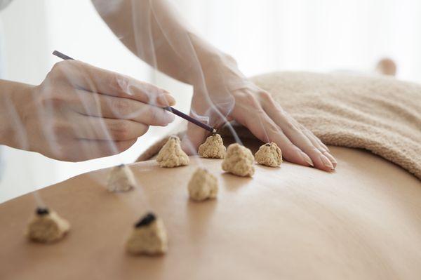 Moxibustion Therapy