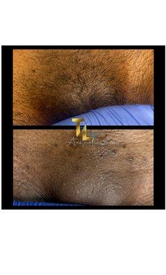 Brazilian Wax