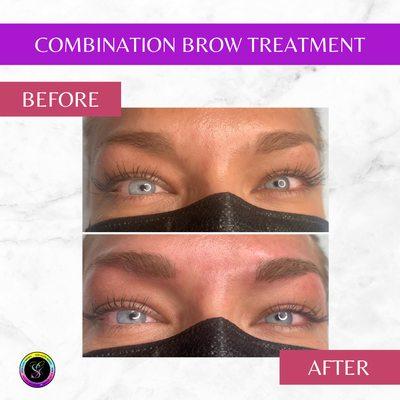 This is after one treatment of our Combination Brow.