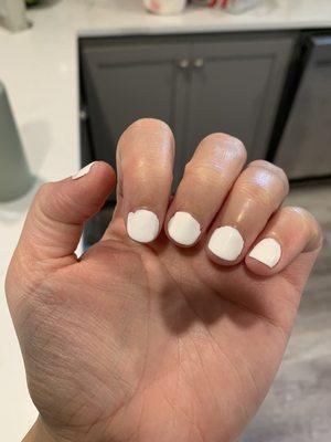 Lifted nails