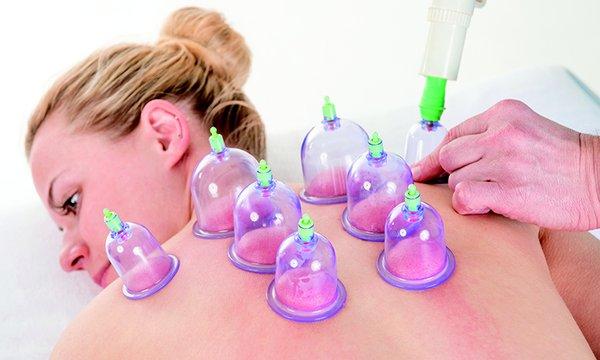 Cupping is an alternative therapy that uses suction cups to stimulate your skin and muscles.