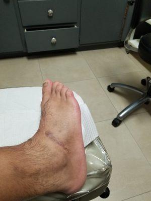 Dr Rabanni is the man I had a foot problem for years he did a very good job