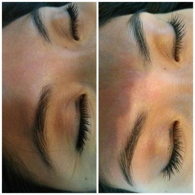 This client has sensitive skin, but with hardwax, the hair is pulled out instead of the skin. She can enjoy clean brows without the damage!