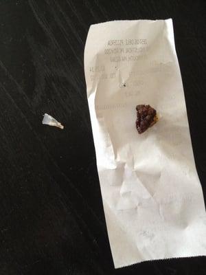 Shard of glass on the left was in our pizza, chunk of old hard grease on the right was in our calzone. How disgusting.