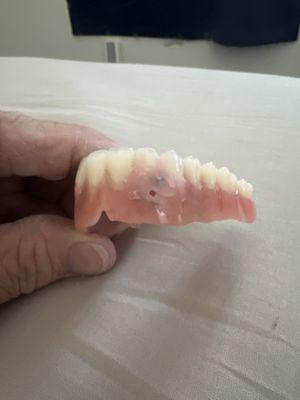 This was what Dr Sharma gave to me as a final denture. See the hole!