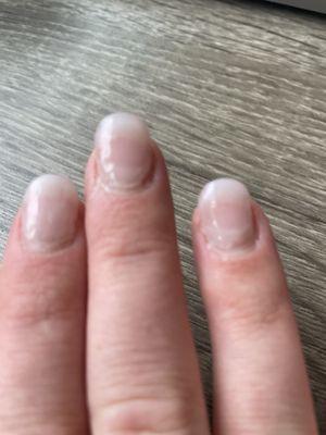 Picture of bad manicure!