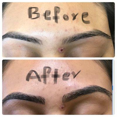 Micro blading