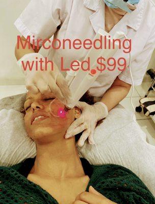 Microneedling with LED anti aging