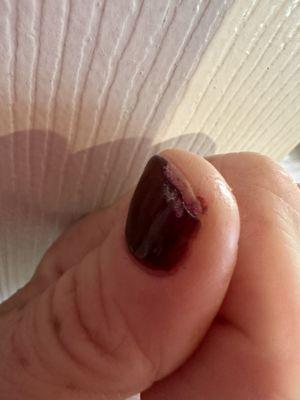 Chipped nail!