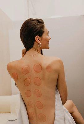 Sun Acupuncture