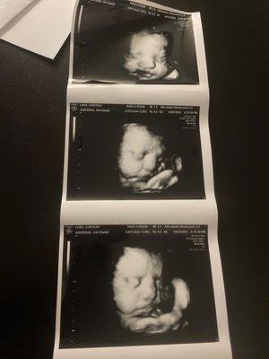 Houston Babies 4d Ultrasound