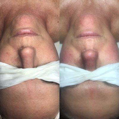 Age Management Facial