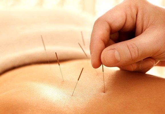 Metropolitan Acupuncture & Herbal Medicine