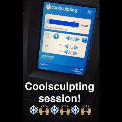 CoolSculpting Session at Our Secret Place