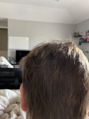 Choppy short layers?