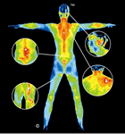 Full Body Thermograms help in early detection.