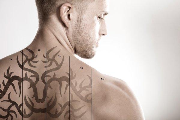 We are the only MedSpa with the fastest Laser Tattoo removal on the market. Less pain, no downtime.