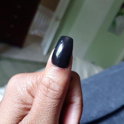 Irritated bleeding nail bed