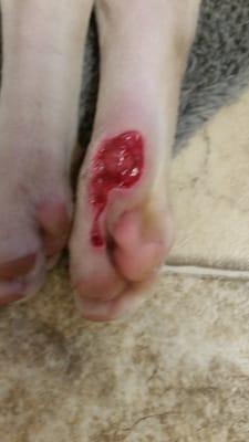 This is his foot and the minor cut they told me he had.