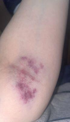 after math of blood work