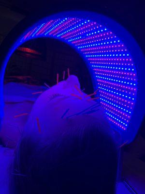 LED light therapy for a patient receiving Cosmetic Acupuncture