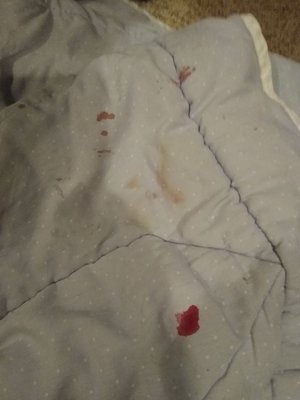 Dog's blood got all over the comforter.