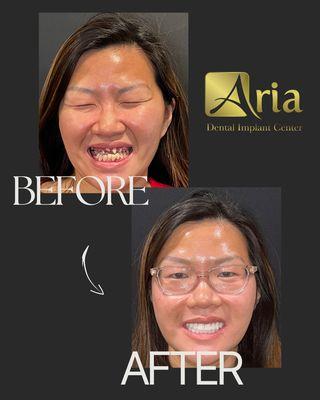 Life changing treatment at Aria Dental Implant Center.