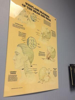 Whiplash and neck injury poster