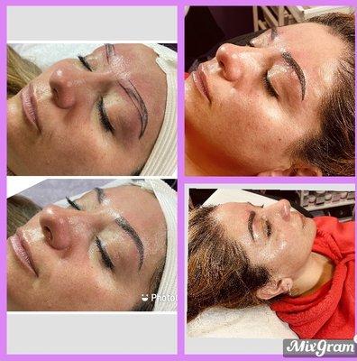 Microblading