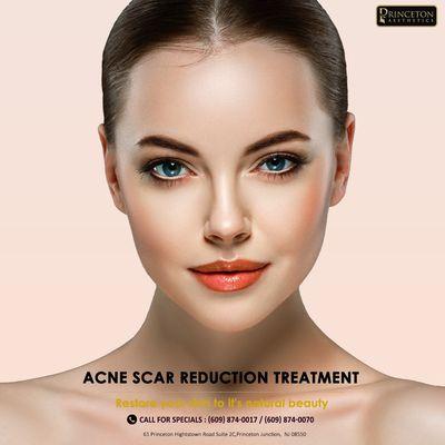 Acne Scar Reduction