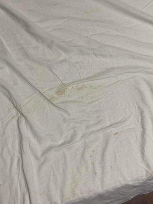 More disgusting stains on "clean" linens