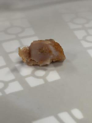 Cartilage found in Chicken teriyaki meatballs