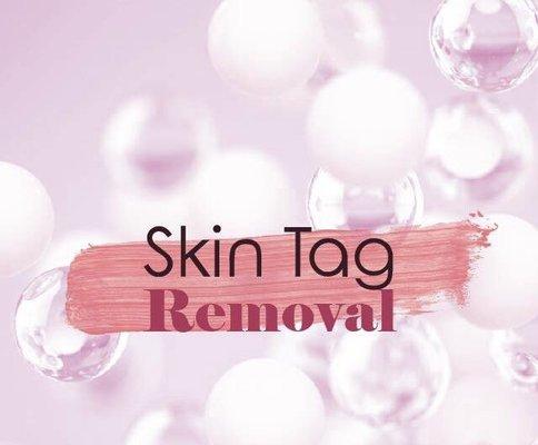 Skin tag removal