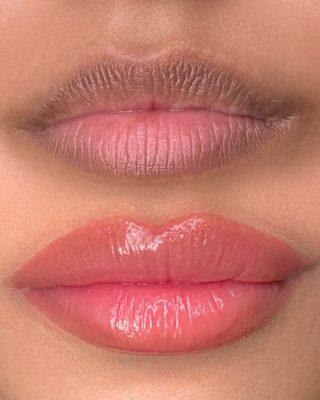 Lip blush neutralization