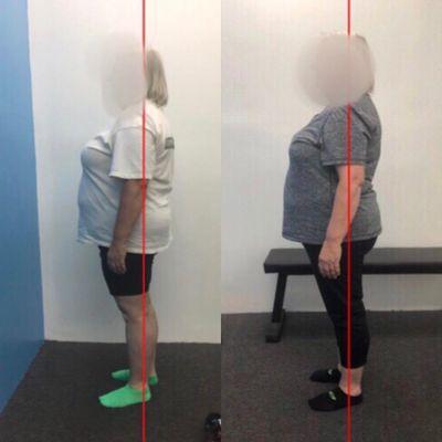 Before and after Egoscue corrective exercise and postural program