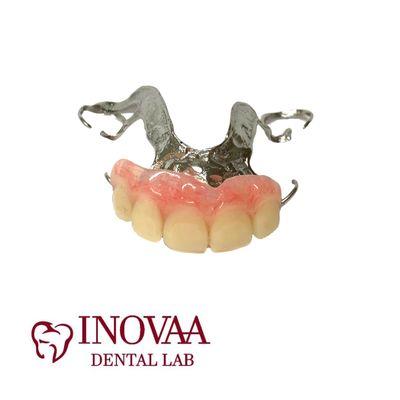 Maxillary Partial Frame