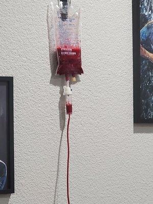 Beautiful cherry red ozonated blood. Ozone therapy has sooo many health benefits!