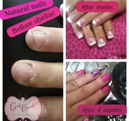 Grow out your  natural nails with CND Shellac or extend them while your grow them out with CND Plexi gel.