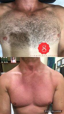 Chest wax before & after