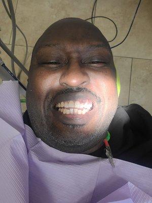 Feelin fine with some shine. People hate to deal with it but take care of your teeth.