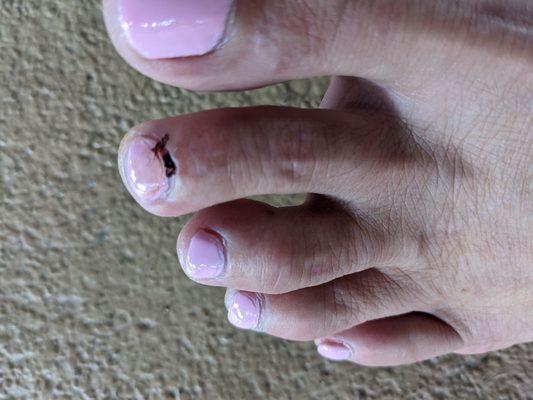 Went to get a Mani Pedi before a wedding and the woman dug the hell out of this toe.  Very disappointed.