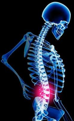 Chiropractor, chiropractic, auto accident, back pain, injury