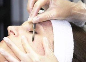 Dermaplaning removes dead skin cells, along with fine hairs, resulting in healthier, brighter, flawless skin.