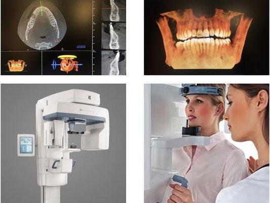 At Howe Dental Associates we always strive to make sure our patients are treated with the best and newest technology. - Cone Beam